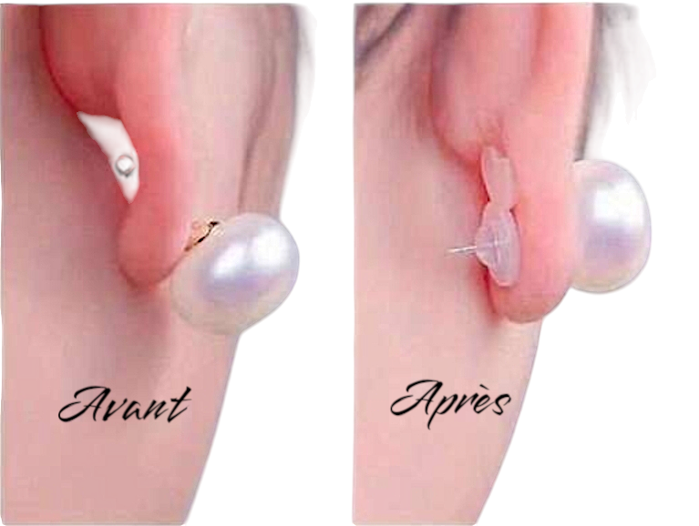 coussinets de soutien invisible pour lobes d'oreilles